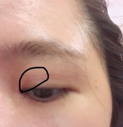 -东莞缔美美容医院