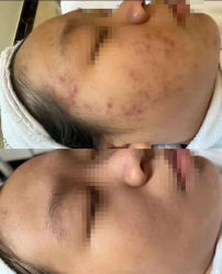 -康美贞·痘肌养护管理中心