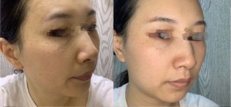 点击看大图 -Yestar艺星医疗美容医院