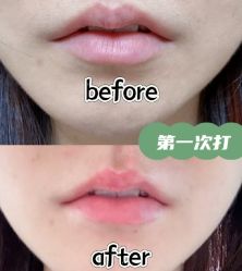 -恒妍医美·韩国定制抗衰中心