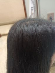 -碧莲盛·不剃发植发