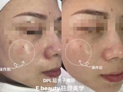 -E.beauty驻颜·痘敏肌调理中心