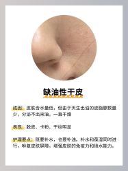 -克丽缇娜