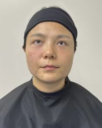 -广州健丽·去眼袋医疗美容机构