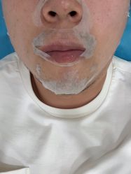 -兰州华美整形美容医院