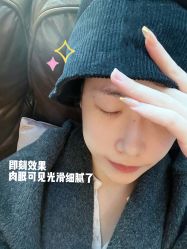 体验后-上海星和医疗美容