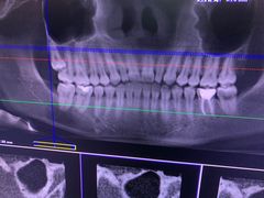 -爱贝口腔·牙周诊疗·种植修复中心