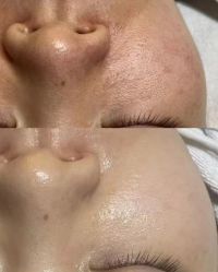 点击看大图 -栖SPA·ONDA ·海菲秀·皑皑科技美肤中心