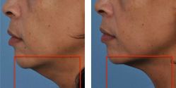 -SKINIST丽铂医疗美容