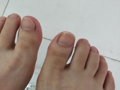 -新甲连锁灰指甲·甲沟炎·鸡眼(黑龙江路店)