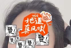 -大麦微针植发全国连锁