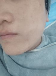 -北京英煌医疗美容·轻颜六区注射修复