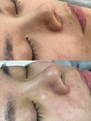 -SKIN79皮肤管理中心