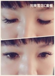 睫毛嫁接-光SPA科技美肤