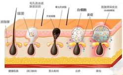 点击看大图 -广州美莱医疗美容医院
