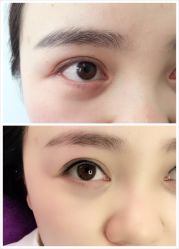 点击看大图 -美莱医学美容医院