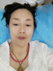体验后-鑫元辰医疗美容整形