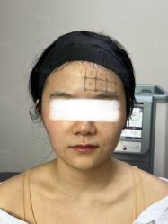 -Yestar重庆艺星医疗美容医院