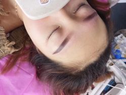 -痣斑堂·取大痣