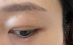 -清疣美疣·痣·斑净肤中心