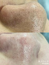 -SKIN79皮肤管理中心