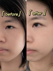 -ST时柒·问题肌抗衰美颜所