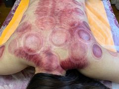 -沈师傅盲人按摩工作室(密三小区店)