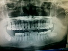 -泰康拜博口腔(世博园乐尔店)