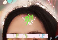 -大麦微针植发全国连锁