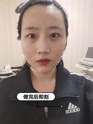 -小忠丽格医美