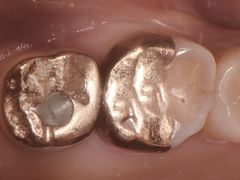 -精德口腔·种植修复·儿牙中心(财富中心店)