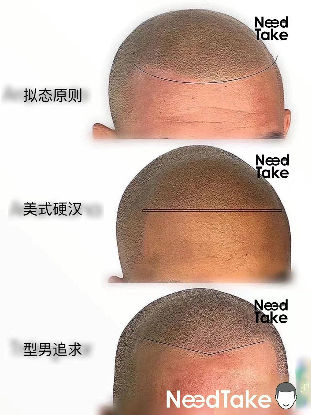 纹发等各种方式
今天给大家推荐几款男士光头纹发的发际线
总有