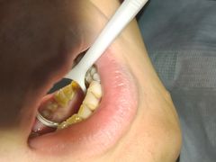 -土豆口腔(凤凰北总店)