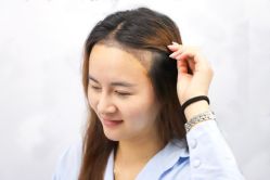 -大麦微针植发丨全国连锁