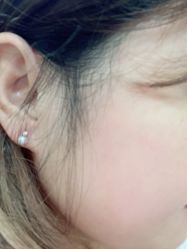 -agge蛋白医美