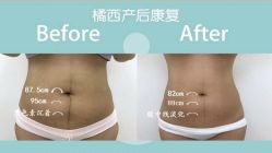 -橘西产后康复中心