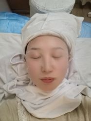 体验后-南昌艾莱芙美容医院