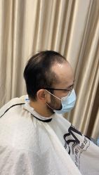 -发饰美男士增发补发假发定制店