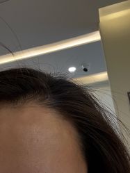 -海涛医疗美容·面部抗衰·注射美鼻