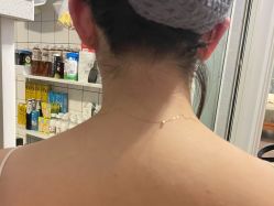 体验后-南京康美美容医院·旗舰店