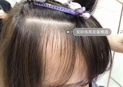 -UnHair Salon