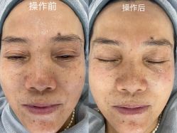 -Cream88颜皮肤管理中心