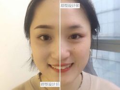 -VON半永久眉学设计