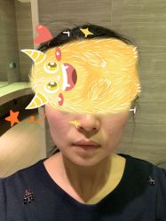 体验后-天津伊美尔医疗整形美容专科医院
