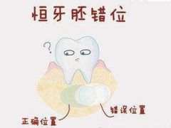 -团圆口腔·种植中心(锦江院区)