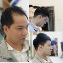 -发饰美男士增发补发假发定制店