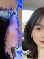 -厦门美莱整形美容医院