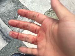 -上海市同济医院(大华门诊部)