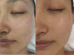 -芳朵美容养生SPA