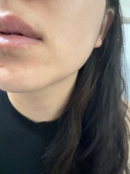 -北京美痣堂古方祛痣斑疣瘊